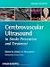 Cerebrovascular Ultrasound in Stroke Prevention and Treatment