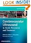 Cerebrovascular Ultrasound in Stroke Prevention and Treatment