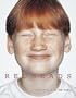 Redheads