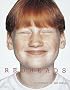 Redheads