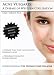   - Acne Vulgaris: A Disease of Western Civilization