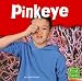 Pinkeye (First Facts)