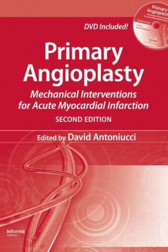 Primary Angioplasty: Mechanical Interventions for Acute Myocardial Infarction, Second Edition
