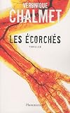 Les écorchés par Chalmet