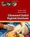 Ultrasound Guided Regional Anesthesia