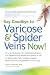 Say Goodbye to Varicose & Spider Veins Now!