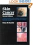 Skin Cancer: An Illustrated Guide to the Aetiology, Clinical Features, Pathology and Management of Benign and Malignant Cutaneous Tumours