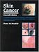 Skin Cancer: An Illustrated Guide to the Aetiology, Clinical Features, Pathology and Management of Benign and Malignant Cutaneous Tumours