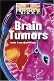 Brain Tumors (Diseases and Disorders)