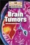 Brain Tumors (Diseases and Disorders)