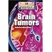 Brain Tumors (Diseases and Disorders)