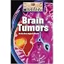 Brain Tumors (Diseases and Disorders)