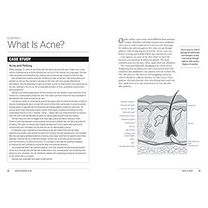 The Complete Acne Health and Diet Guide: Naturally Clear Skin Without Antibiotics