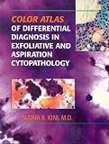 Color Atlas of Differential Diagnosis in Exfoliative and Aspiration Cytopathology