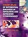 Book Color Atlas of Differential Diagnosis in Exfoliative and Aspiration Cytopathology