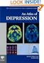 An Atlas of Depression (Encyclopedia of Visual Medicine)