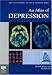 Search : An Atlas of Depression (The Encyclopedia of Visual Medicine Series)