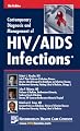 Contemporary Diagnosis and Management of HIV/AIDS Infections