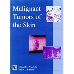 Malignant Tumors of the Skin