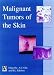Book Malignant Tumors of the Skin