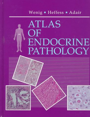 Endocrine-Diseases