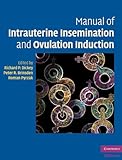 Manual of intrauterine insemination and ovulation induction