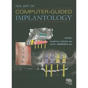 Click here to buy Art of Computer-Guided Implantology by Philippe Tardieu and Alan Rosenfeld.