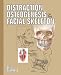 Distraction Osteogenesis of the Facial Skeleton