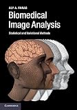 Biomedical image analysis : statistical and variational methods