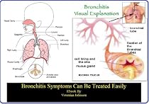 Click to Download Free Kindle Book -> Bronchitis Symptoms Can Be Treated Easily