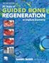 20 Years of Guided Bone Regeneration in Implant Dentistry