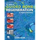 20 Years of Guided Bone Regeneration in Implant Denistry by Daniel Buser