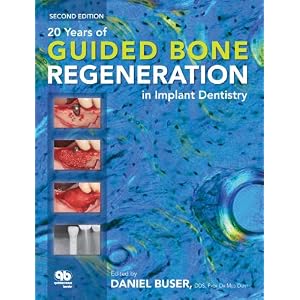 Click here to buy 20 Years of Guided Bone Regeneration in Implant Denistry by Daniel Buser.