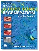20 Years of Guided Bone Regeneration in Implant Denistry