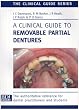 A Clinical Guide to Removable Partial Dentures