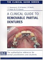 A Clinical Guide to Removable Partial Dentures