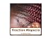 Traction Alopecia (Dermatology)
