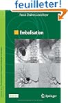 Embolisation
