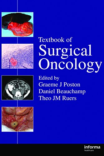 Textbook of Surgical Oncology