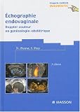 �chographie endovaginale