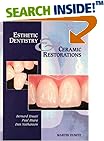 Esthetic Dentistry and Ceramic Restorations