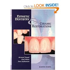 Aesthetic Dentistry and Ceramic Restorations