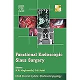 Functional Endoscopic Sinus Surgery - ECAB-Wow! eBook