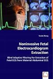 compare prices and find the best deal on domain pr, Noninvasive Fetal Electrocardiogram Extraction 