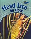 Head Lice Up Close (Perspectives)