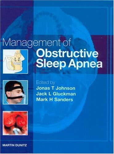 Management Of Obstructive Sleep Apnea