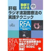 動画でわかる肝癌ラジオ波凝固療法の実践テクニック