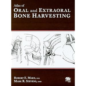 Click here to buy Atlas of Oral and Extraoral Bone Harvesting by Robert E. Marx and Mark R. Stevens.