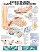 Understanding Carpal Tunnel Syndrome