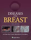 Diseases of the breast